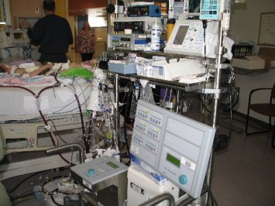 The ECMO pump